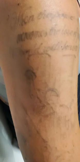 Before: script lettering on the forearm